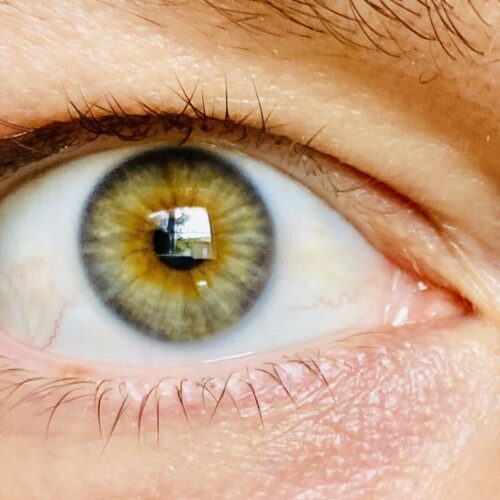 Jennifer Colucci's eye